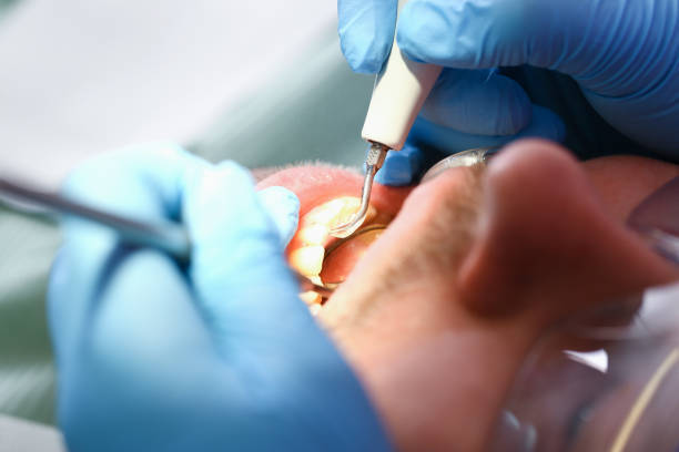 Best Emergency Gum Treatment in Hart, MI